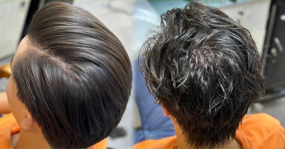 Hair treatments